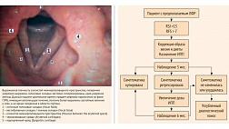 ЛАРИНГОФАРИНГЕАЛЬНЫЙ РЕФЛЮКС: КЛИНИЧЕСКОЕ ЗНАЧЕНИЕ, СОВРЕМЕННЫЕ ПОДХОДЫ К ДИАГНОСТИКЕ И ЛЕЧЕНИЮ